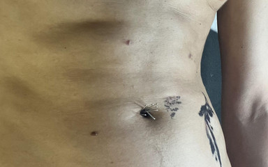The Torment of Kevins Belly Button
