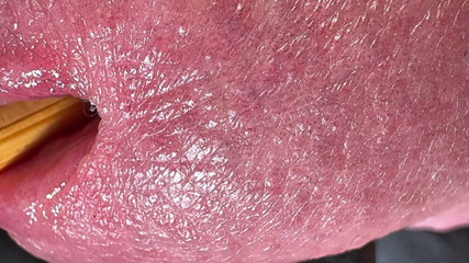 Acorn and My Hole Make Me Happy