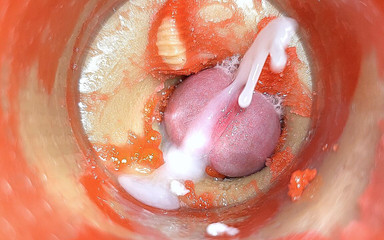 Camera in Anal Cervix POV, Tiny Cucked by Giant ''couple'', Cum in Anal and Creampie - Asmr