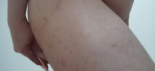 Digging Chubby Ass with a