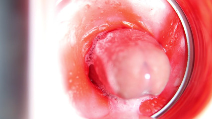 Camera Inside Pussy: Big Cumshot in Pussy! Best Internal Asmr in 4K