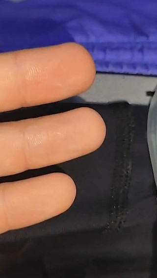 The Dick Had to Be Implanted Slowly.