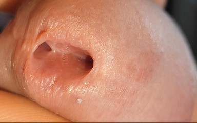 Big Sexy Hole Being Opened to the Extreme