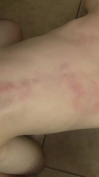 Making This Little Prick Howl