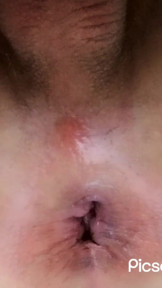 Asshole