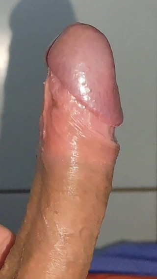 Large Deformed Cock with Lumpy Glans.