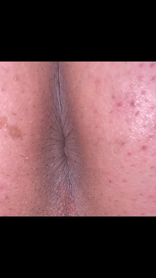 A man exposes his asshole Take a picture so that wrinkles can be clearly seen