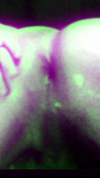 Get a Trip to My Ass