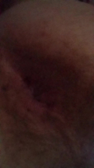 Pulse Ass